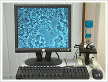 位相差顕微鏡と画像ーお口の中のばい菌を採り、患者様にも診ていただきます。 